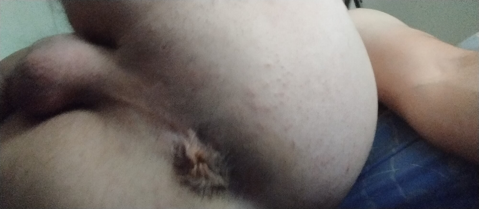 Anal #4