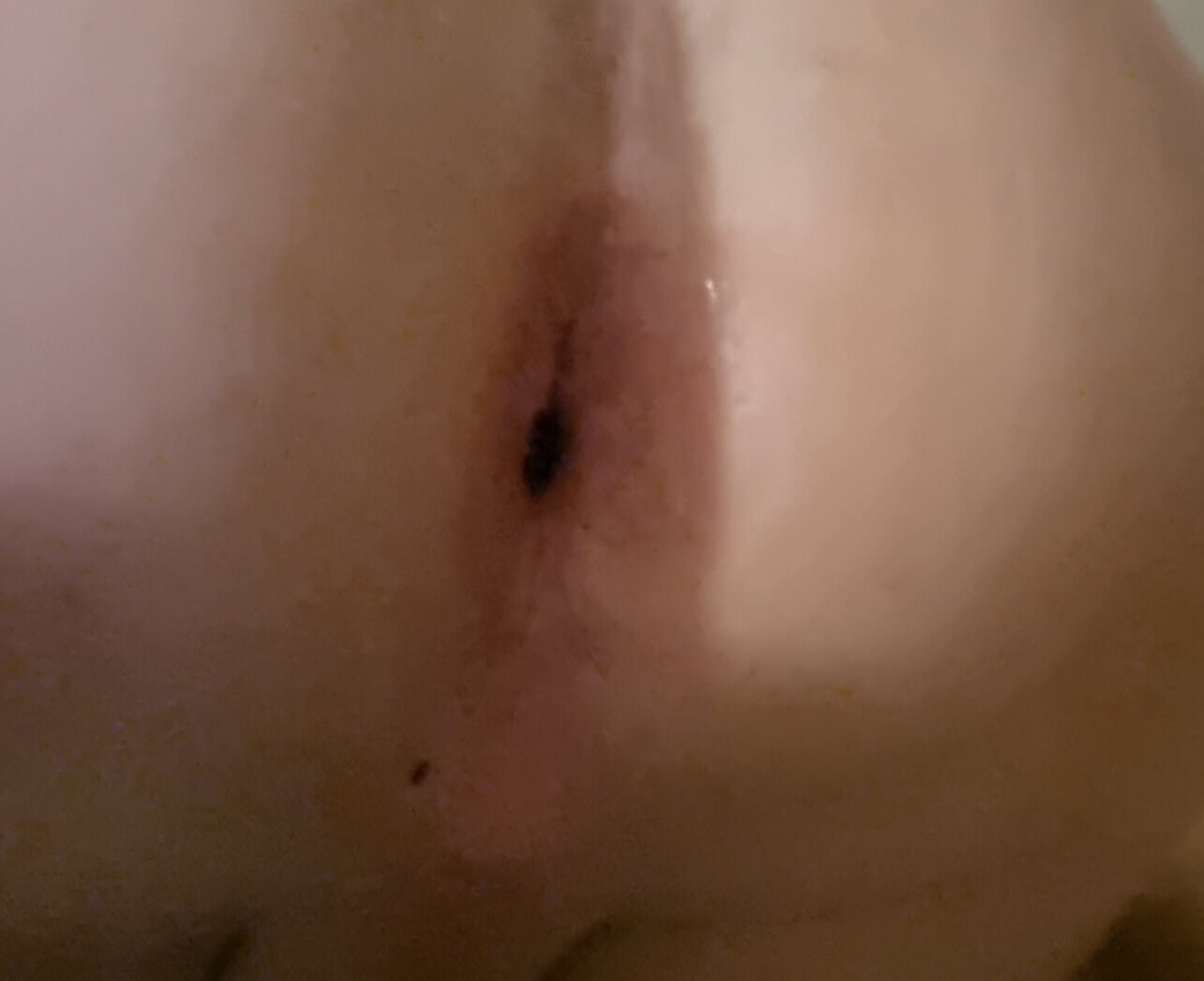 Mein Arsch danach #3