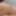 Teaser 