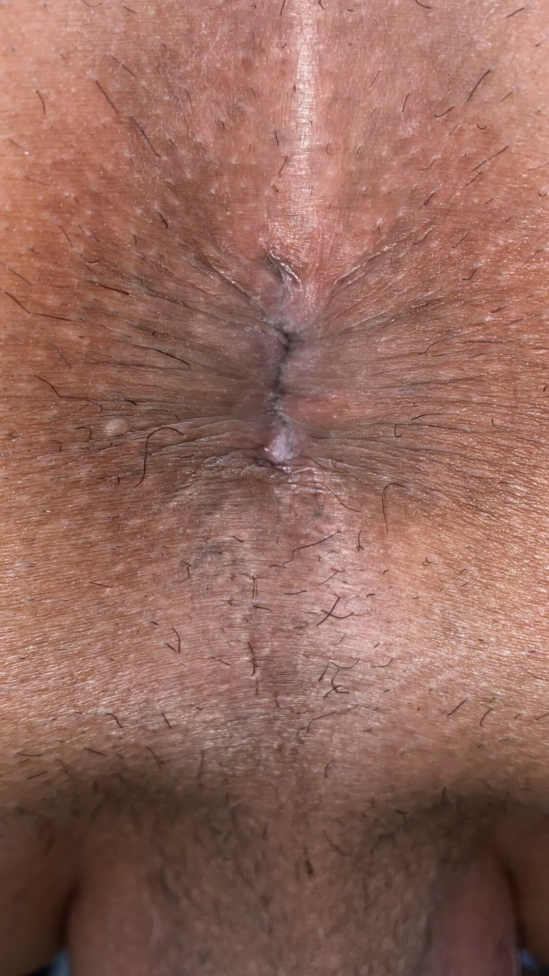 Close-up of a man's anus #47