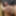 Foreskin and shorts