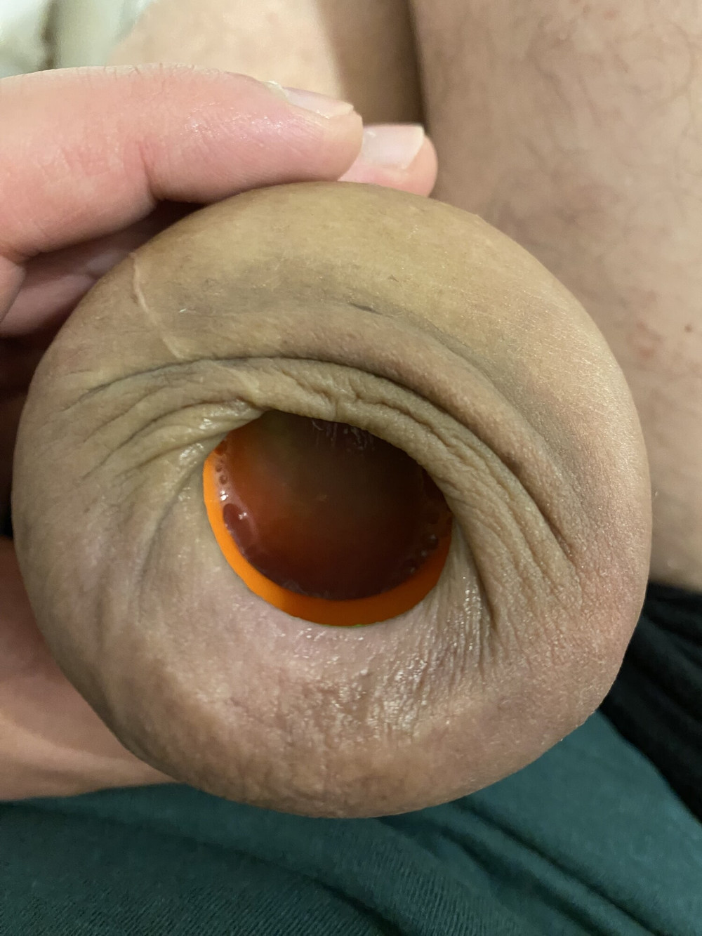 Foreskin stretching donut ring #8