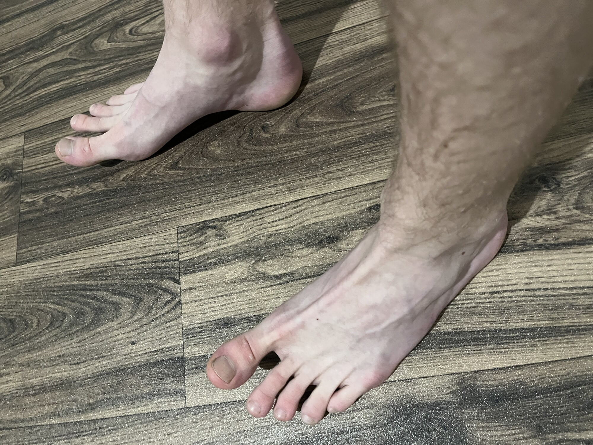 My feet #14