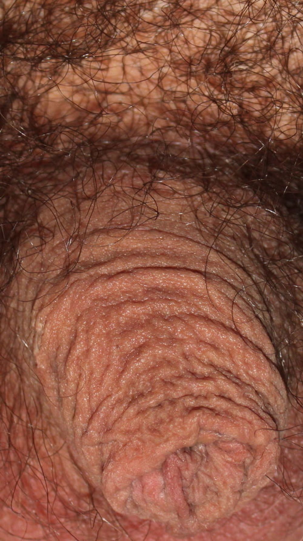 My foreskin #59