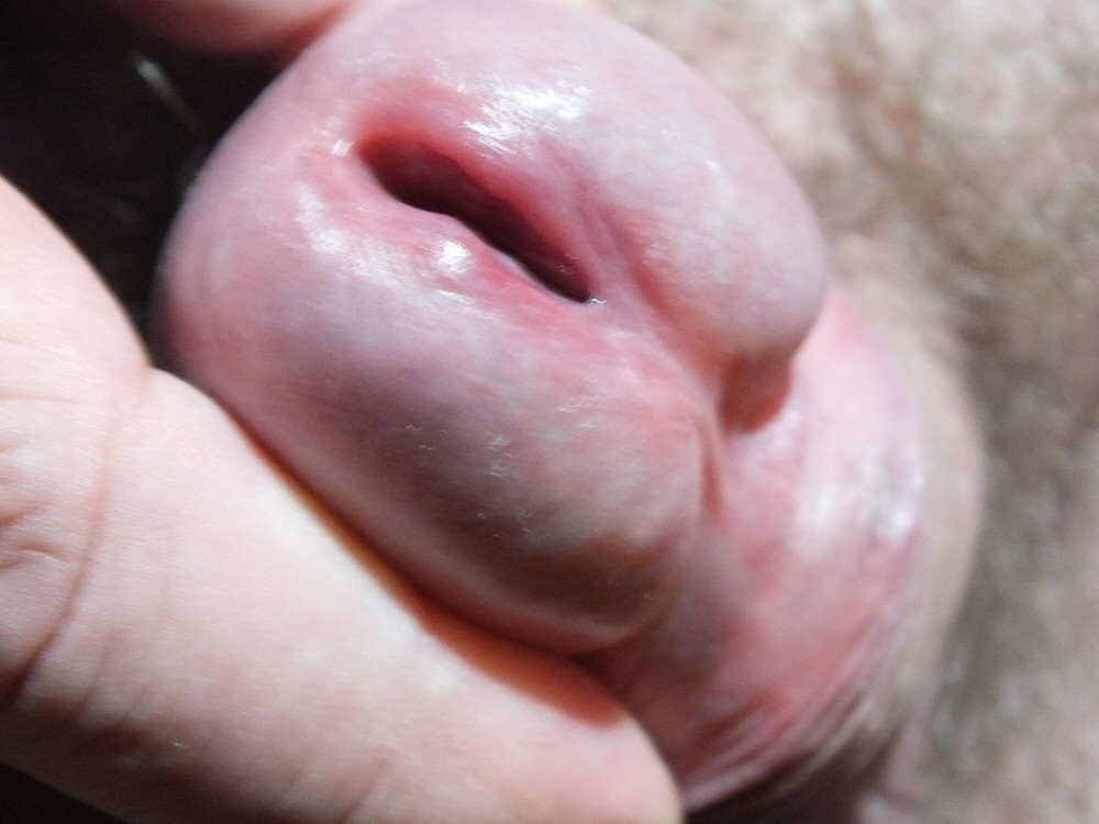 My cock close up #7