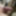 Swollen dick from penis pump