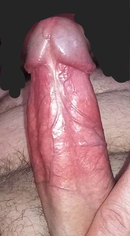 My penis #7