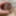 Foreskin extending with donut ring