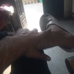 My leg photo