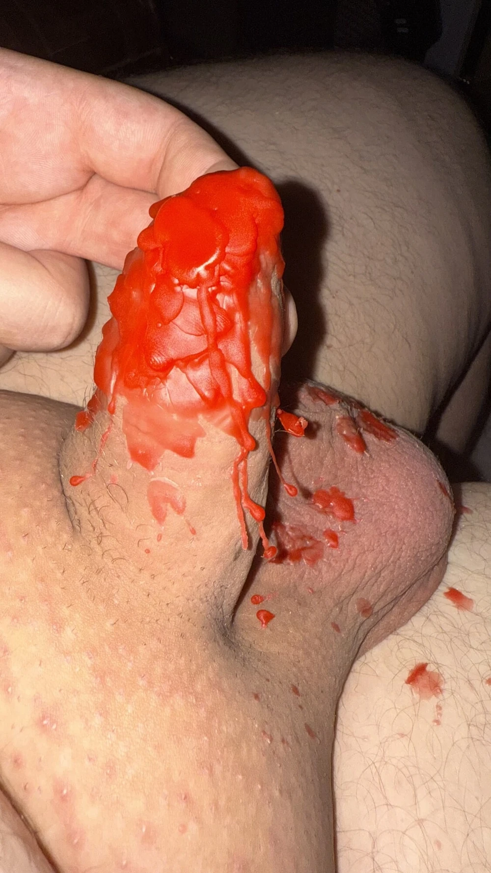 foreskin closed with candle wax #4