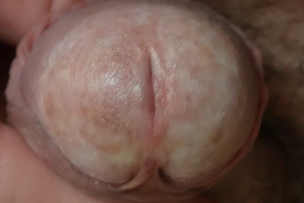 close up penis