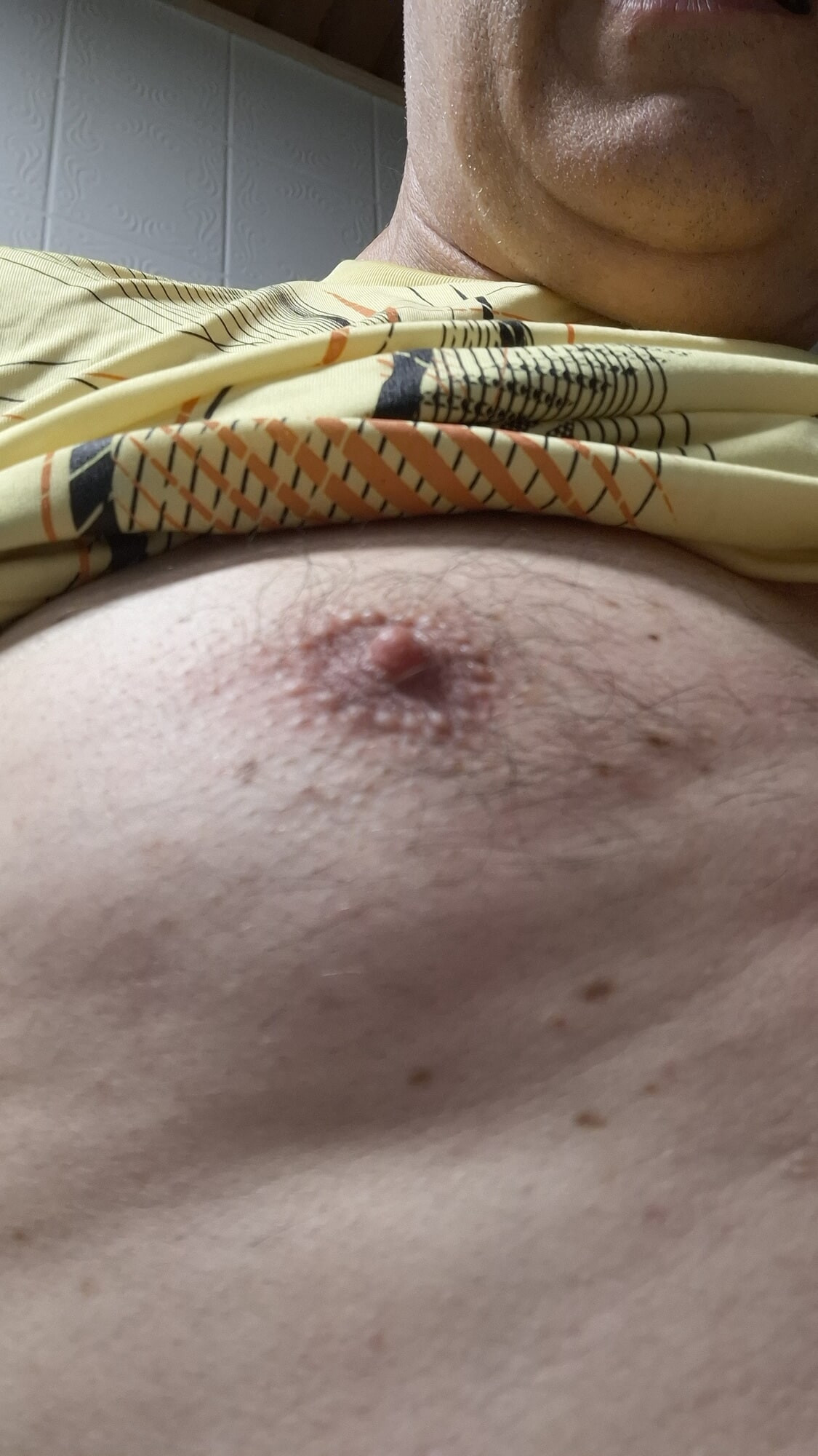 Nips