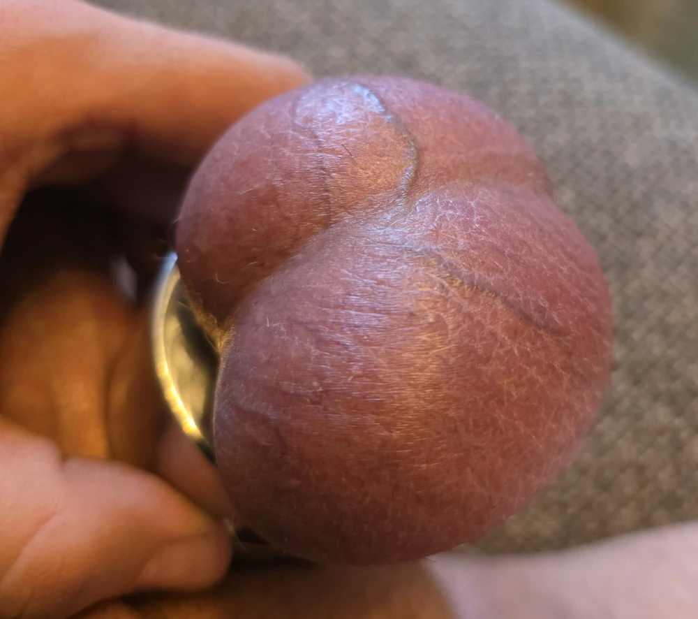 Ball Stretcher #3