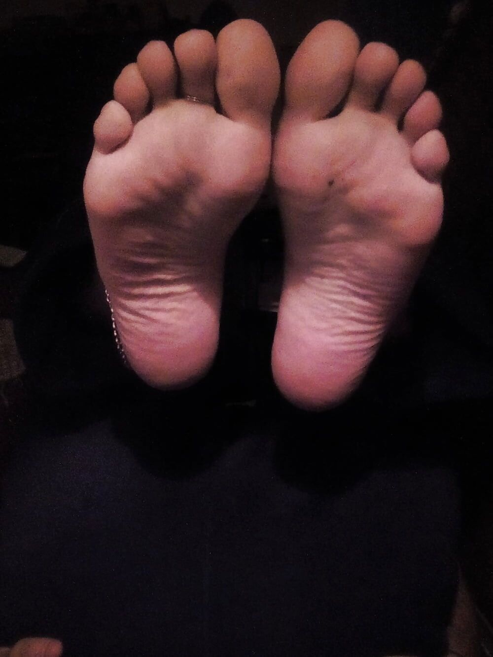 MyFeet #21