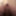 Anal  #3