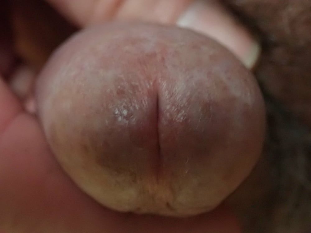 my penis up close #5