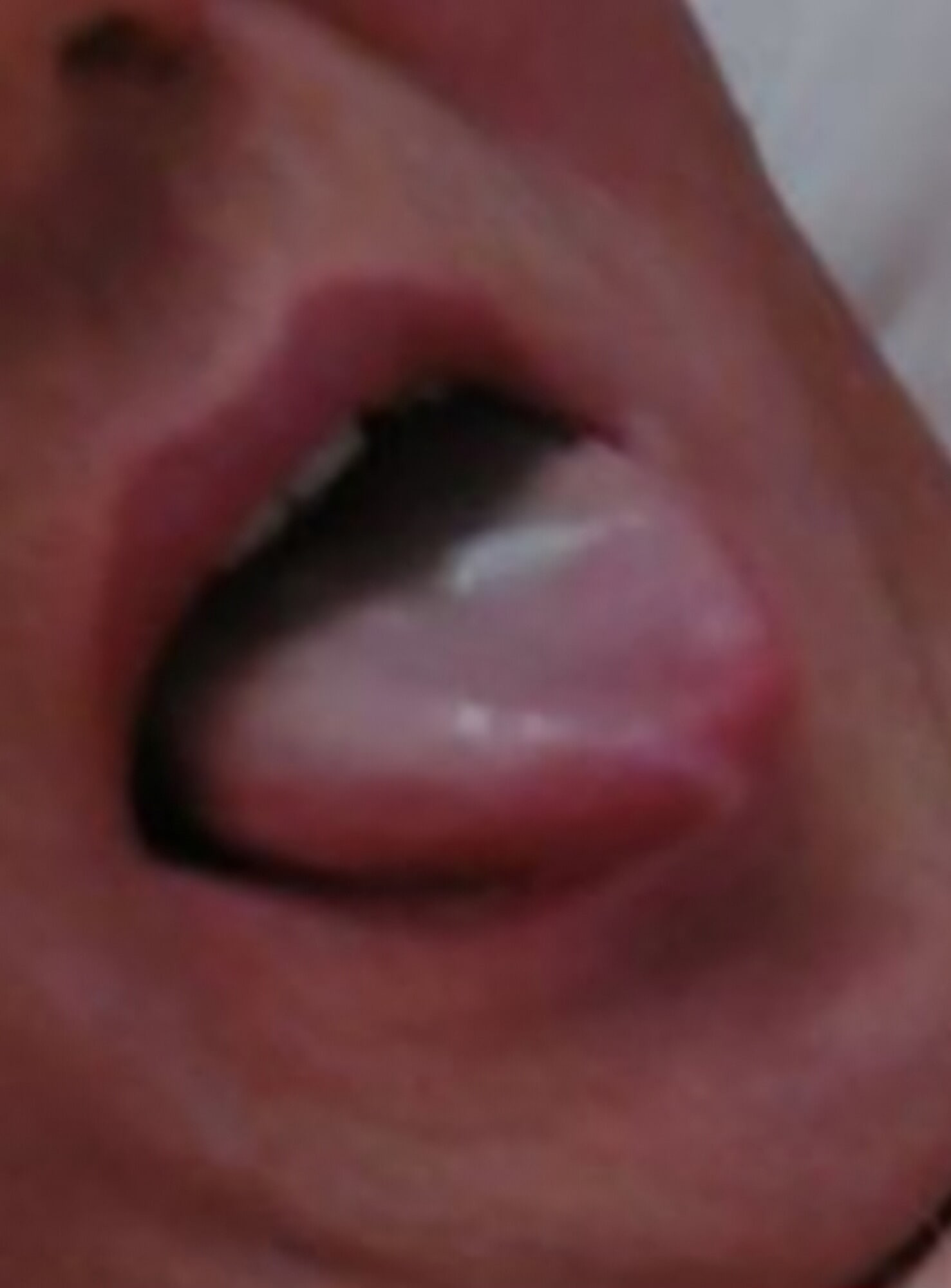 แกลเลอรี่ของฉัน