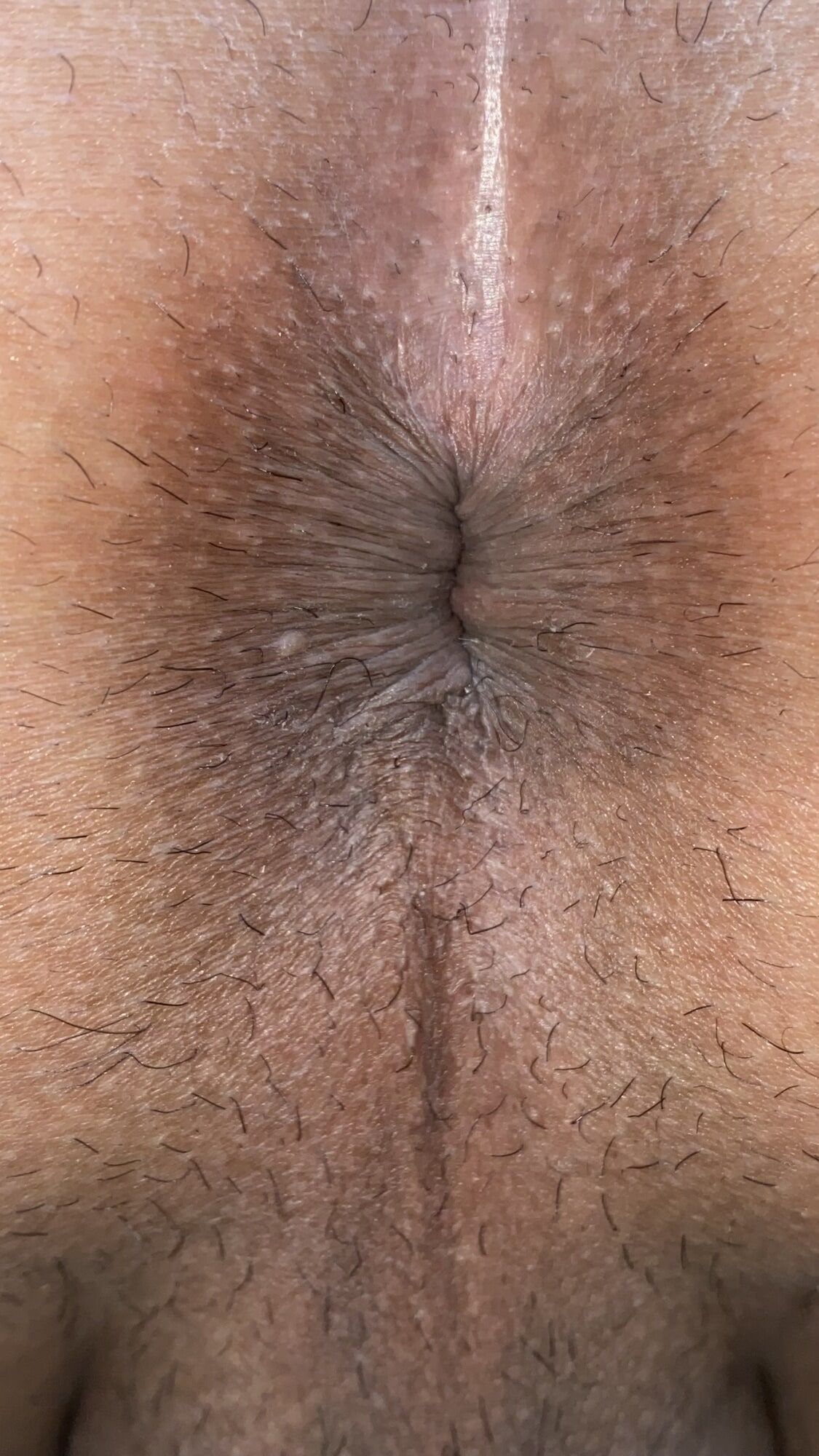 Close-up of a man's anus #35