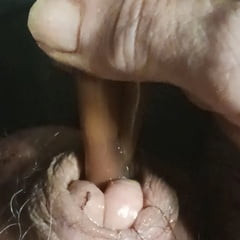 Catheter 