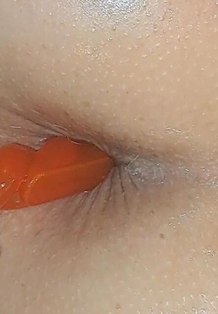Anal  #2