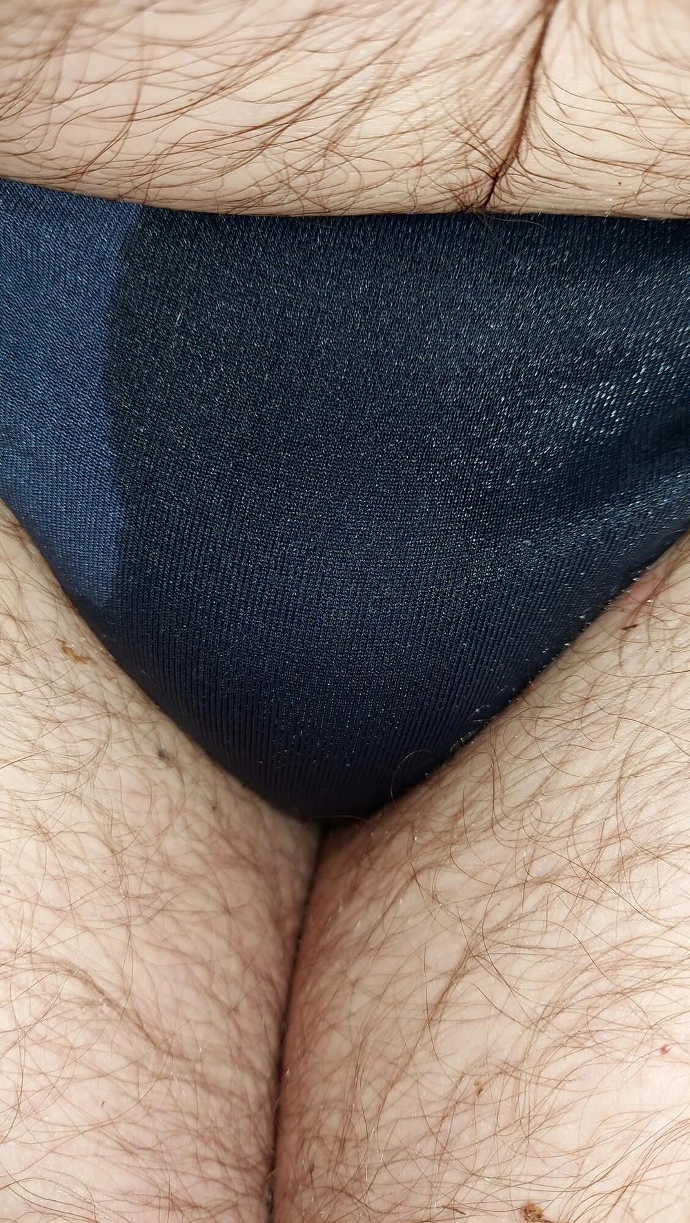 ich #2