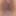 Close-up of a man&#039;s anus