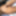 Skin legs 