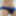 More of my cock in hot pants underwear - Hypospadias UK #8
