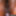 Extream Black Vulva Closeup Of Sheisnovember Black Vagina #14
