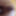 Anal Gaping aand Bedpost 