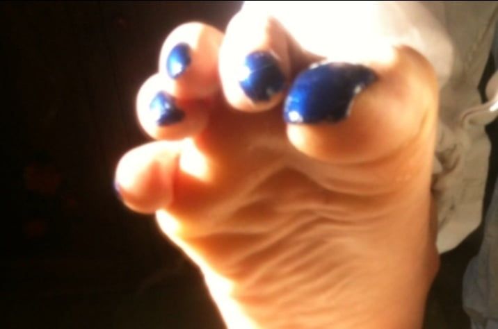 Blue toenails under sun ray #21