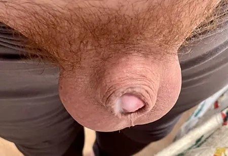 my tiny inverted cock         