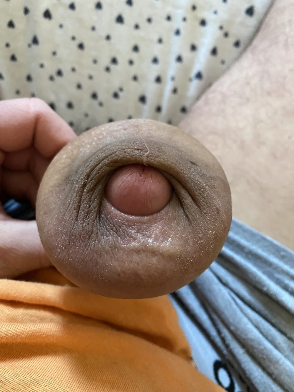 extreme stretching foreskin #5