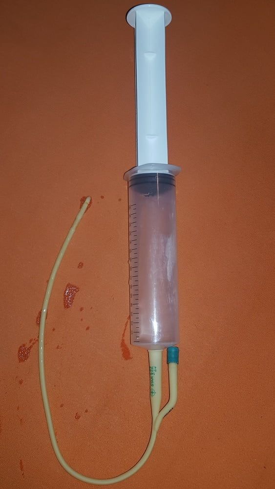 Catheter sounding with my urine 2 #36