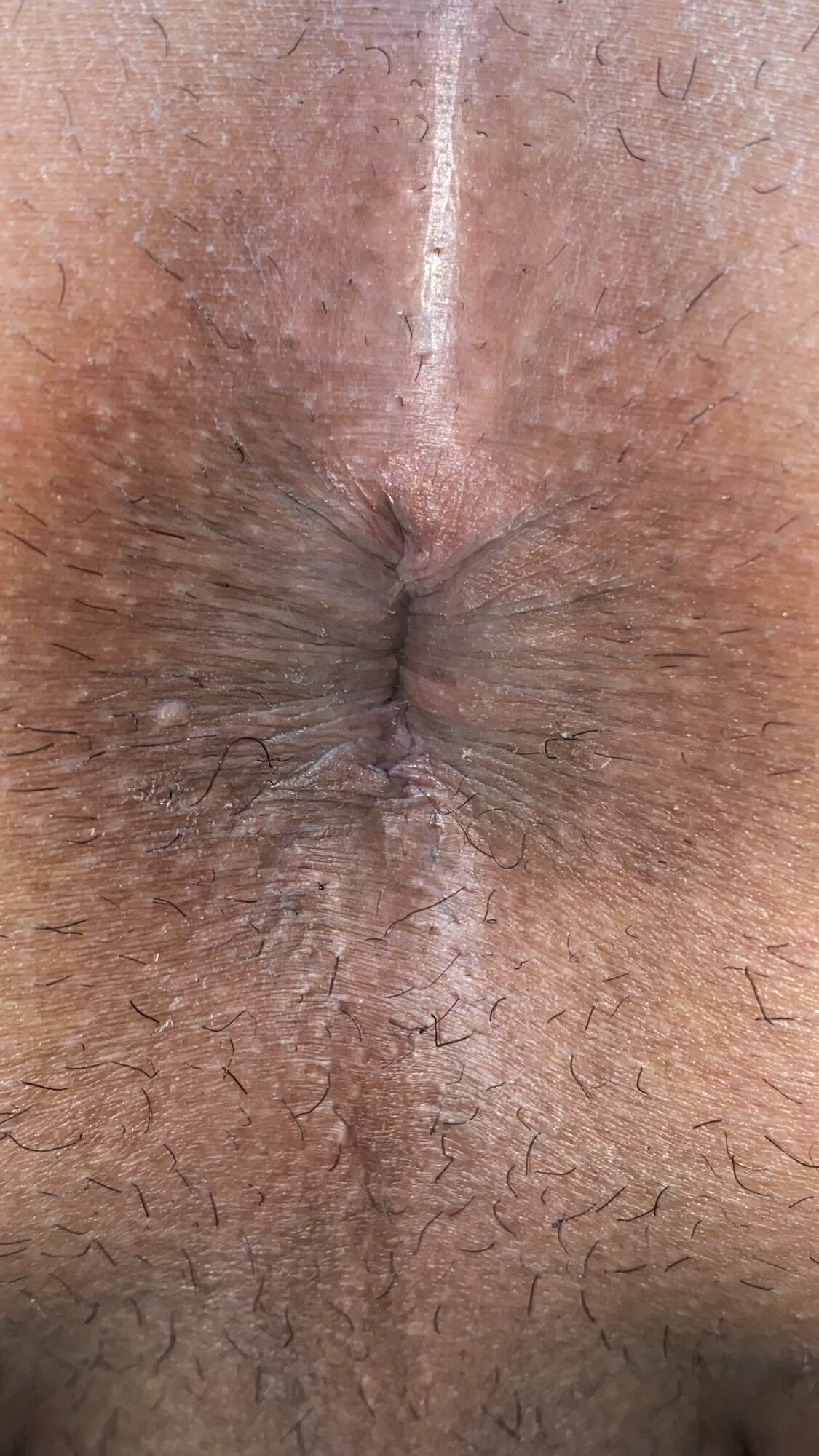 Close-up of a man's anus #36