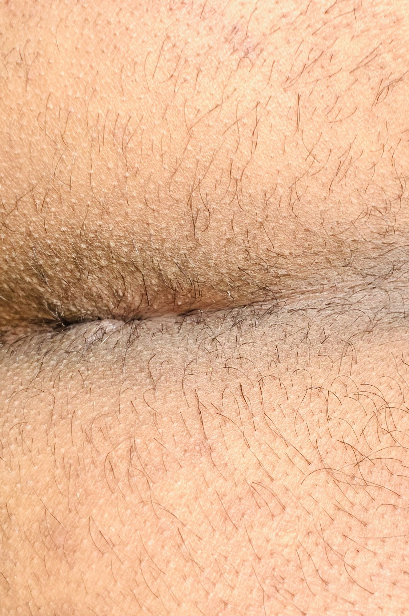 Close up Asshole #3
