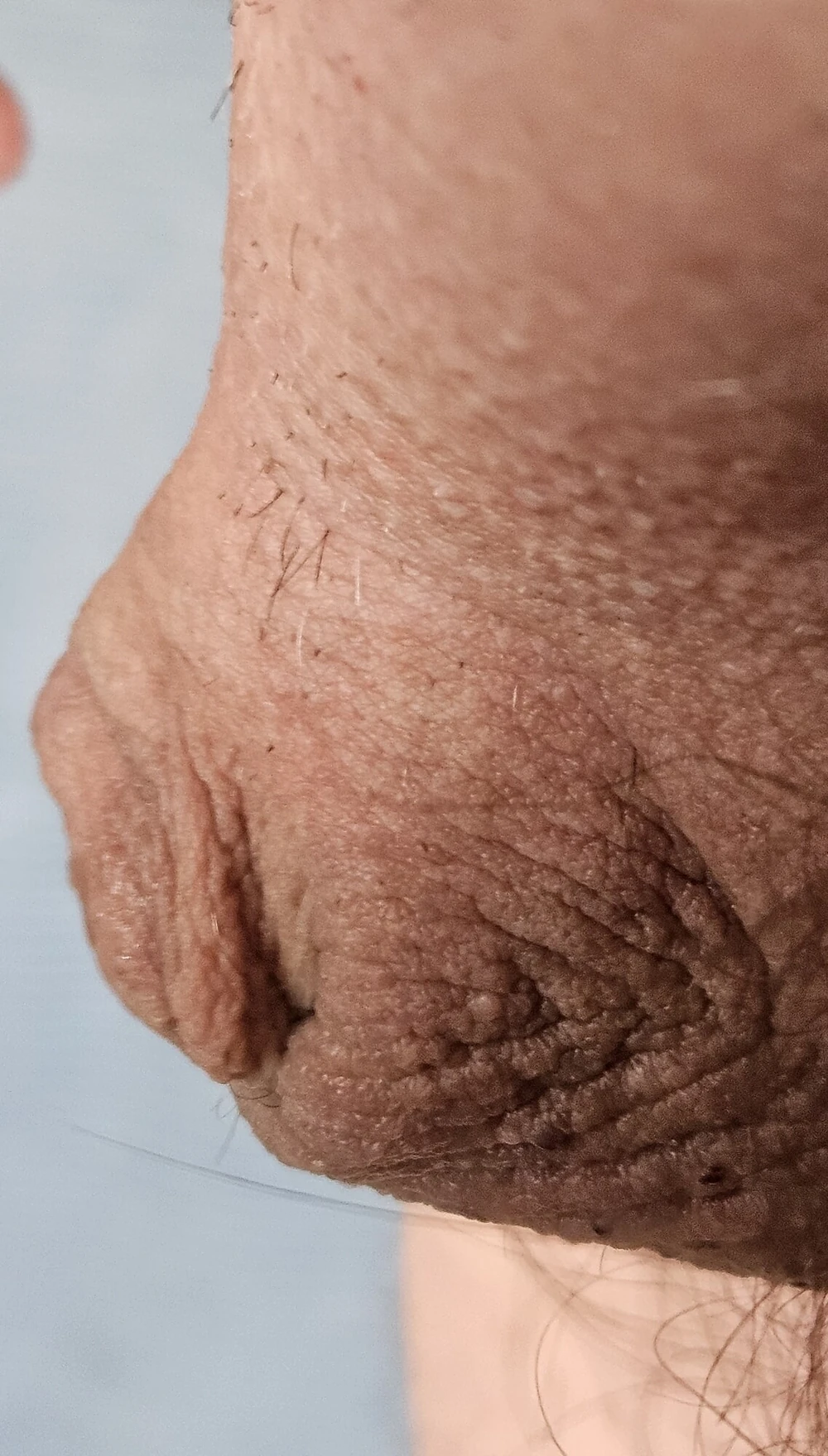 Micro Penis #2