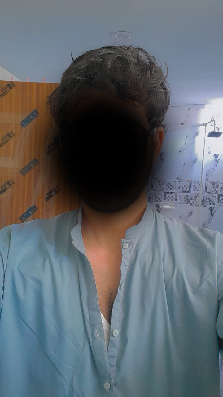 Me face blur #3