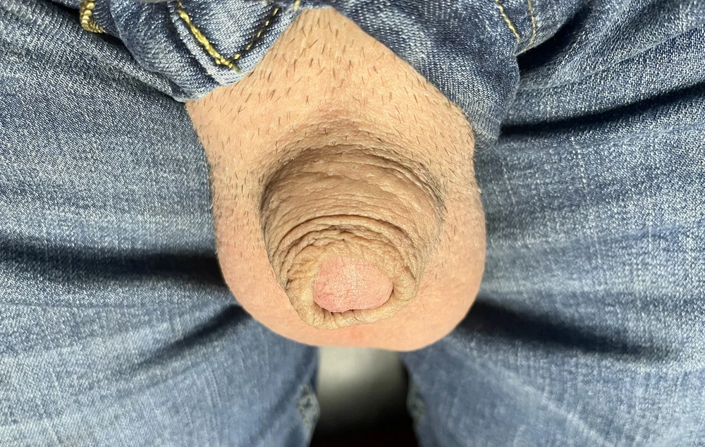 Tiny micro cock pics #6