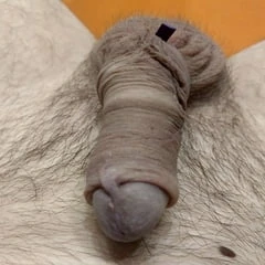 Limb cock banding