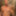 teaser