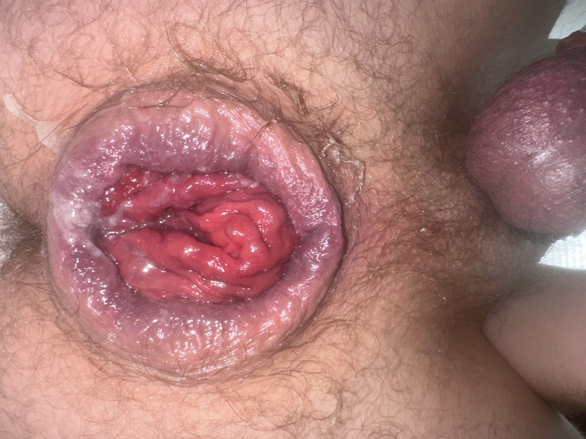 Anal prolapse in oxball ff pighole #16