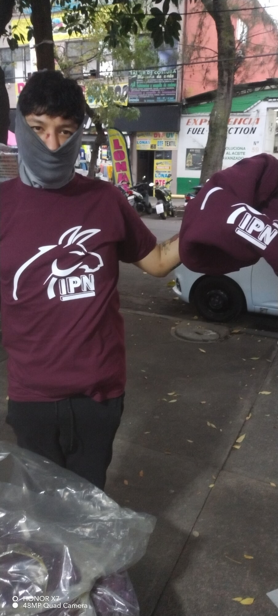 Algo normal