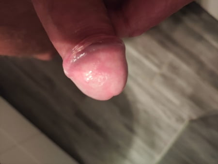 wet glans
