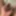 extended foreskin #5