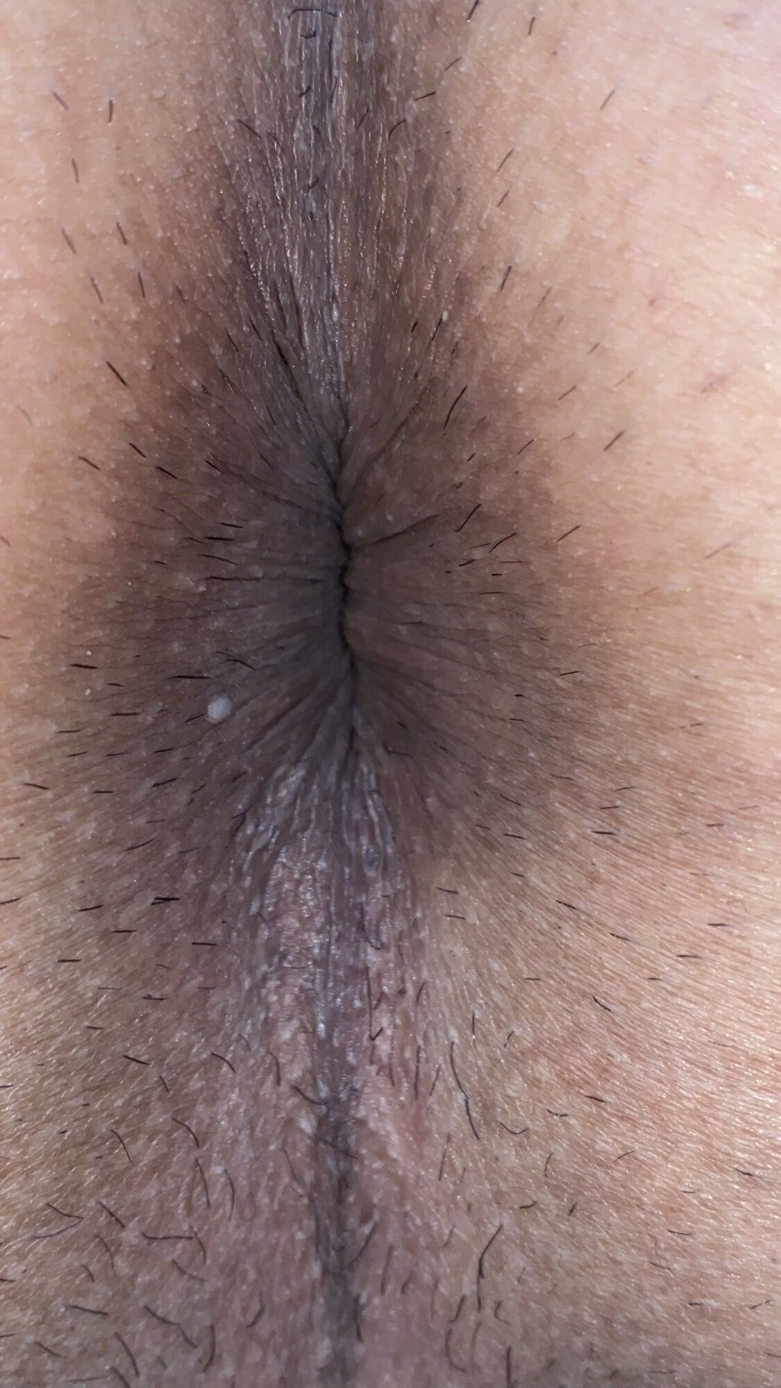 An image of my anus that is clear to every single wrinkle #14