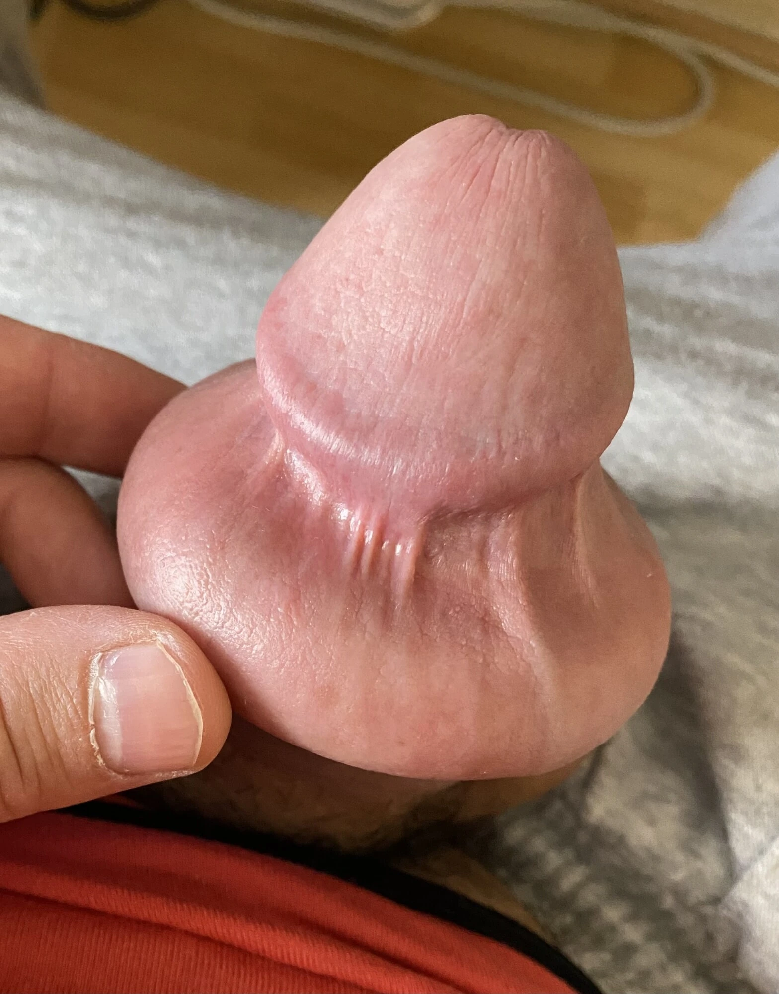 Foreskin extreme stretching porn