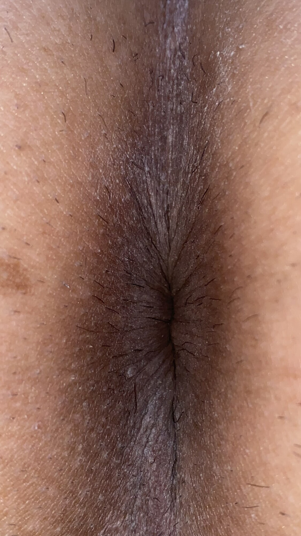 Close-up of a man&#039;s anus #49