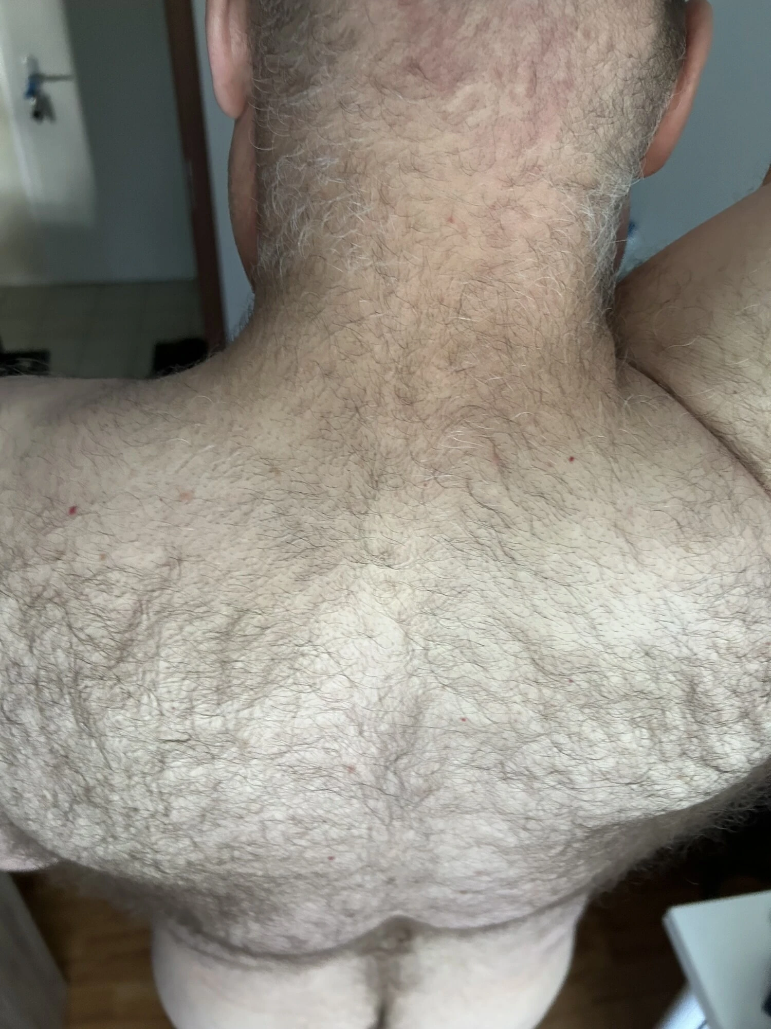 Hairy Body 
