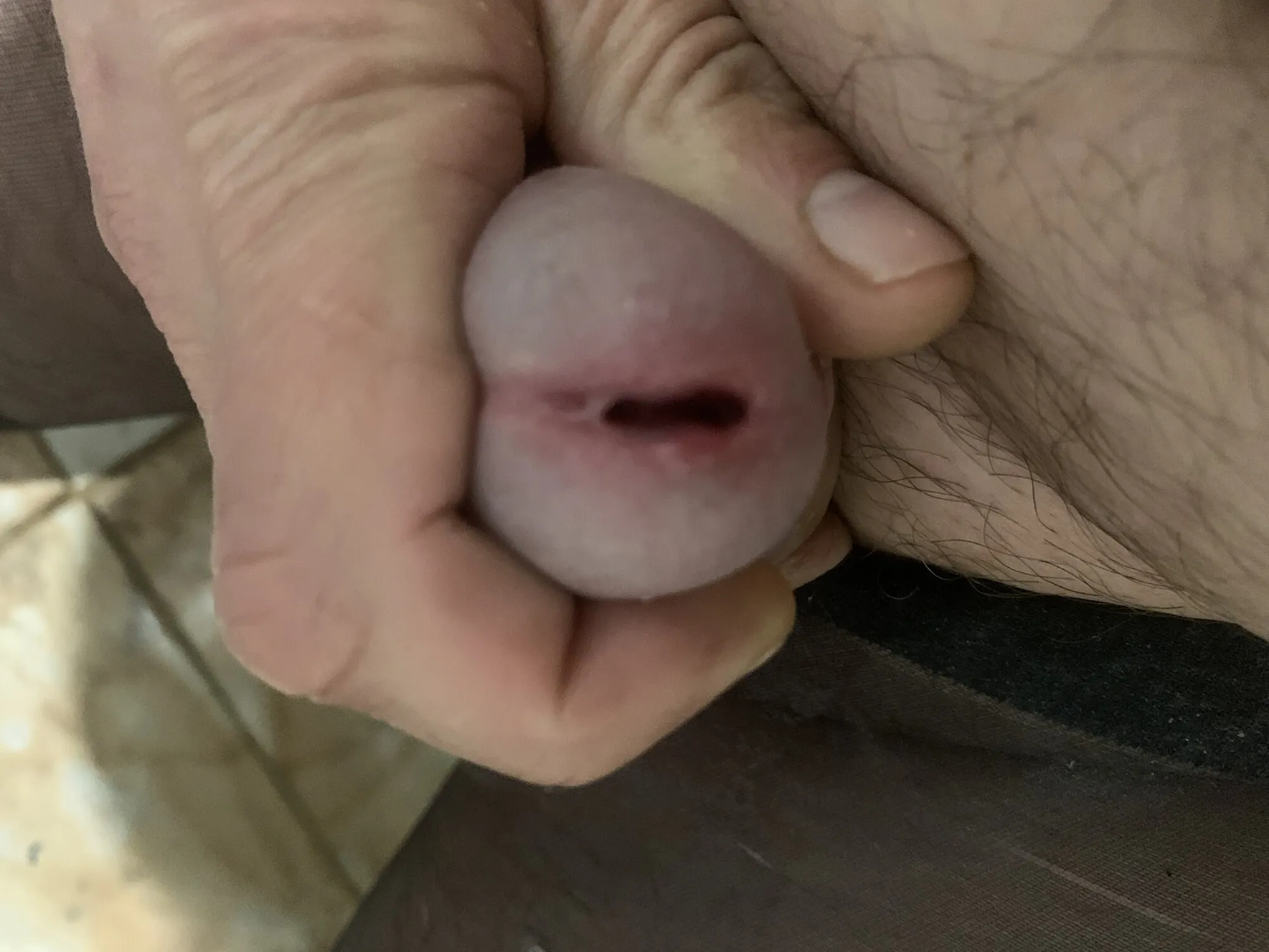 My penis